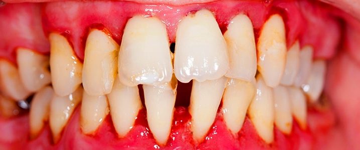 Derniers articles