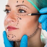 traitement d’une cicatrice après lifting du visage
