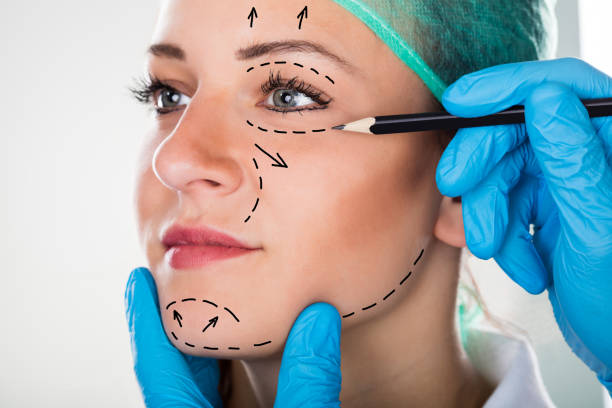 traitement d’une cicatrice après lifting du visage
